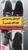 تونیک ضد ریزش و و رویش مجدد مو دوقلو برند اکسونیک درمان ریزش سکه ای مو-معجزه قرن تحت لیسانس المان مستقیم از نمایندگی ایران زمین