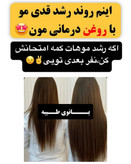 تونیک ضد ریزش و و رویش مجدد مو دوقلو برند اکسونیک درمان ریزش سکه ای مو-معجزه قرن تحت لیسانس المان مستقیم از نمایندگی ایران زمین