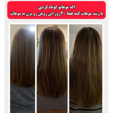 تونیک ضد ریزش و و رویش مجدد مو دوقلو برند اکسونیک درمان ریزش سکه ای مو-معجزه قرن تحت لیسانس المان مستقیم از نمایندگی ایران زمین
