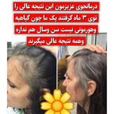 تونیک ضد ریزش و و رویش مجدد مو دوقلو برند اکسونیک درمان ریزش سکه ای مو-معجزه قرن تحت لیسانس المان مستقیم از نمایندگی ایران زمین