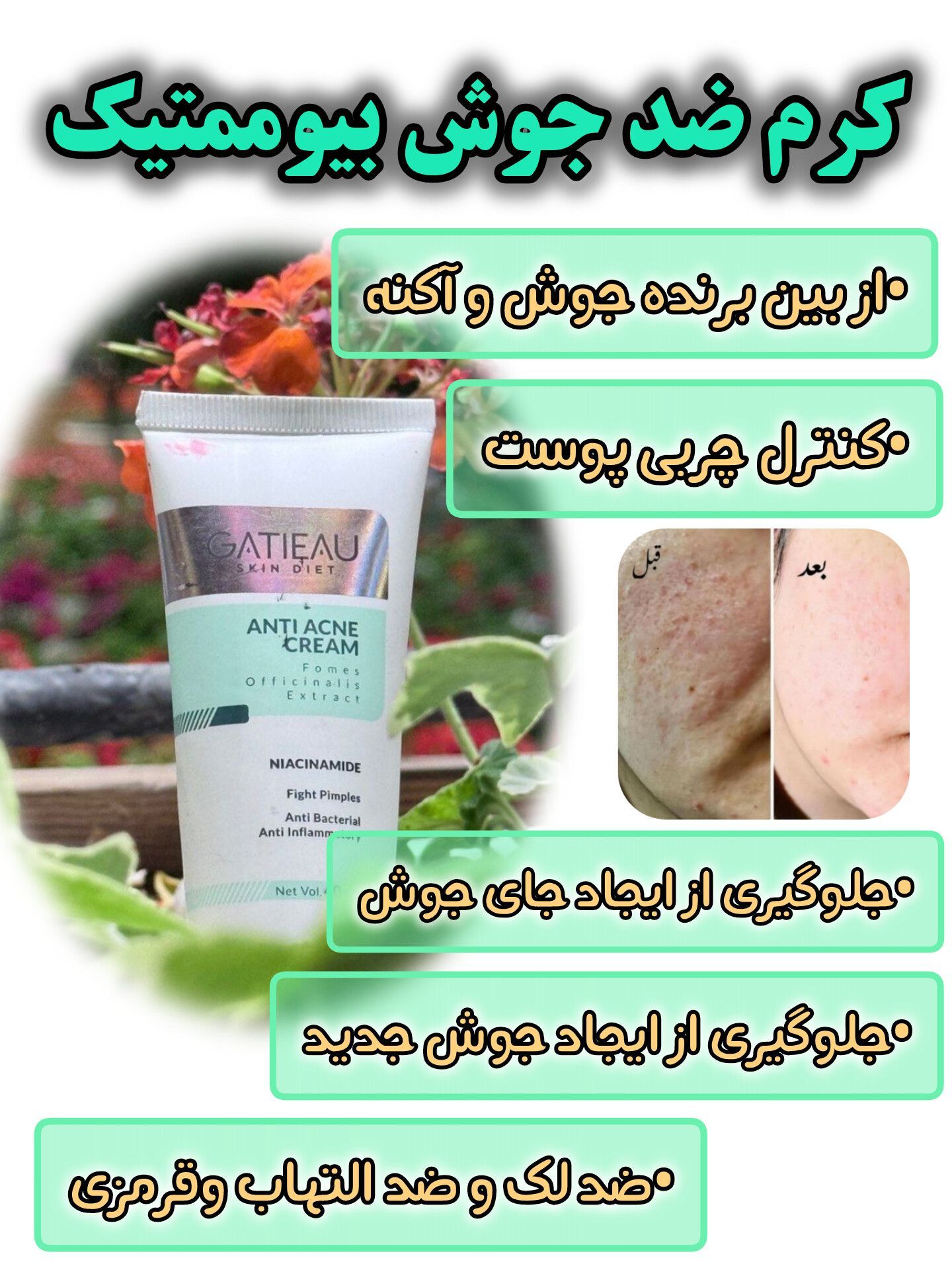 کرم ژلی ضد جوش و ضد لک برند گاتیو اصل ایتالیا رفع جای جوش/ابرسان/ضد لک حجم 40 میل